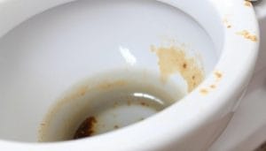 How to remove mineral deposits from toilet bowl